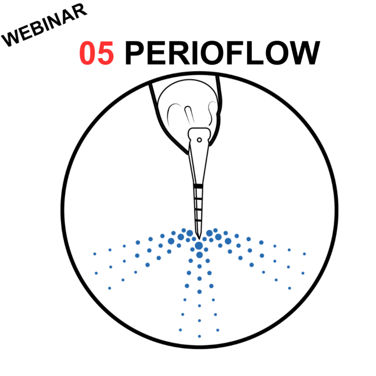 Webinar: Utilizzo del PERIOFLOW® nello Step 5 della Guided Biofilm Therapy (GBT)
